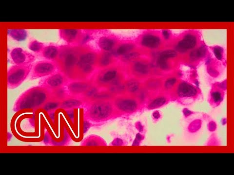 ‘Tumors just vanished’: Cancer patients now in remission after drug trial